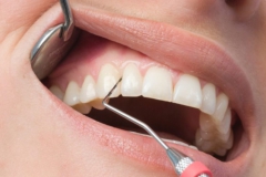 Klempka-Dental-Periodontics-1