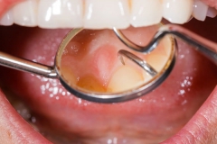 Klempka-Dental-Periodontics-2