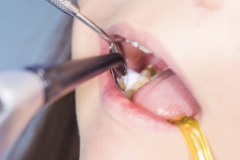 Klempka-Dental-restorative
