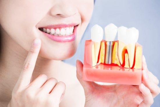 dental implant services chicago